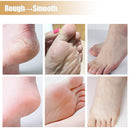 SK363-Anti-Drying Crack Foot Cream