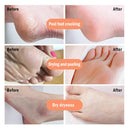 SK363-Anti-Drying Crack Foot Cream